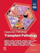 Diagnostic Pathology: Transplant Pathology 3rd Edition | آسیب شناسی تشخیصی: آسیب شناسی پیوند ویرایش سوم